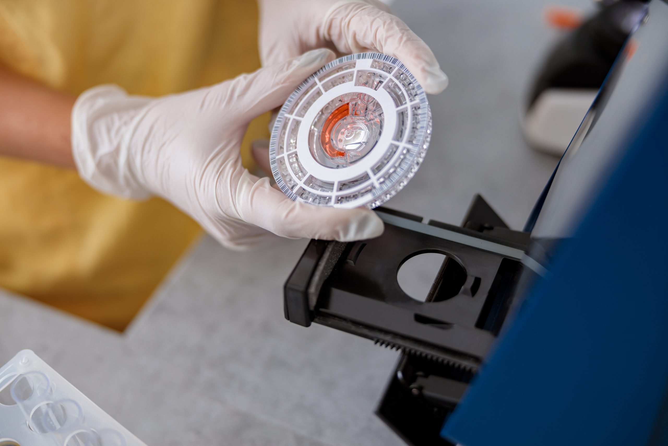 ¿Para qué se utiliza un lector de ELISA?