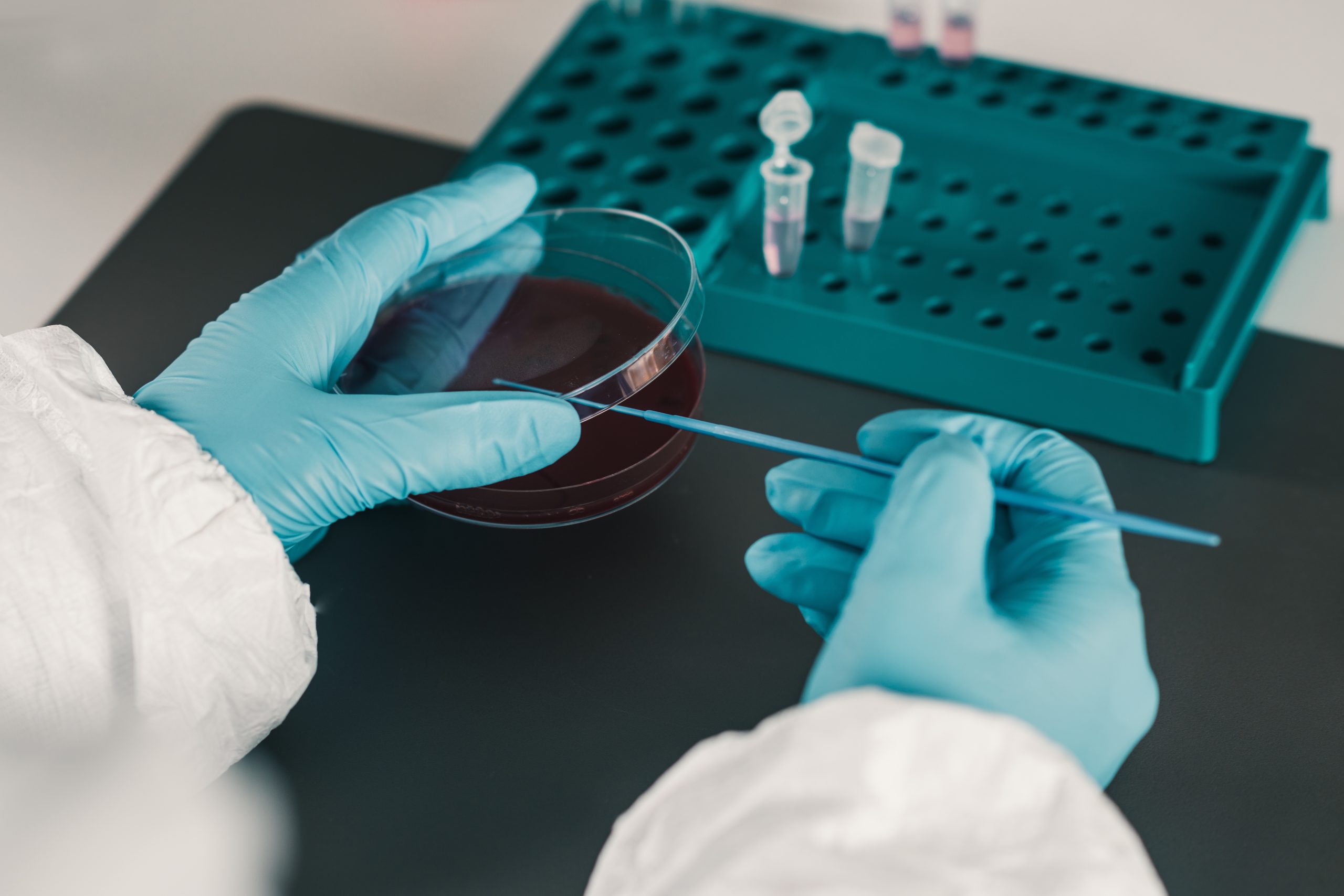 ¿Qué es un lector de microplacas?