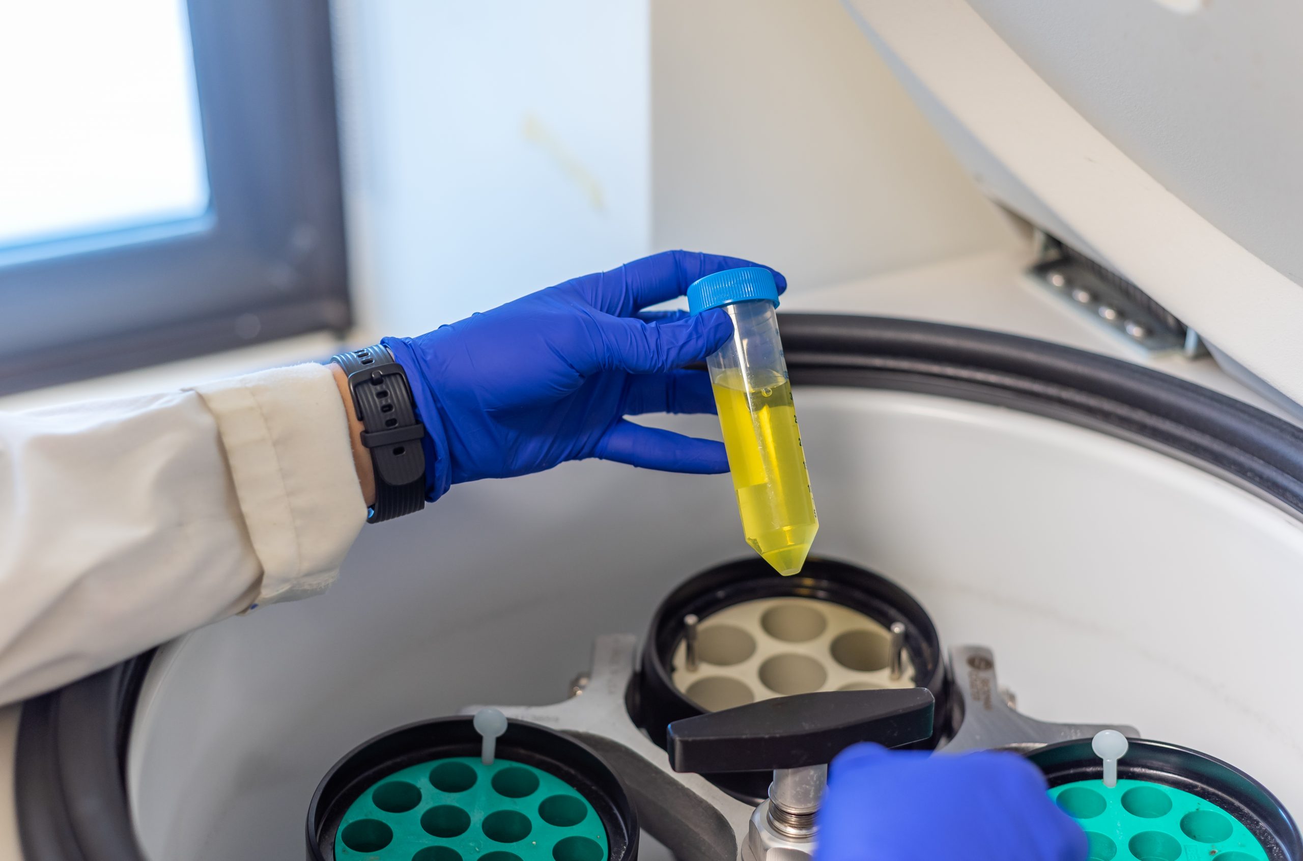 Centrifuga: ¿Cómo separar muestras?