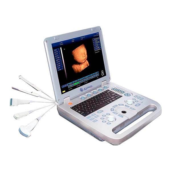 Análisis Comparativo de Ultrasonido Obstétrico 3D4D: Kalstein vs. GE Healthcare